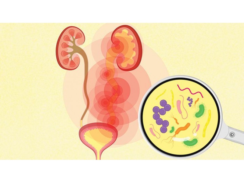 What should you do if you have UTI?