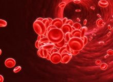 How to prevent thrombosis?
