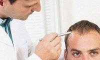 Main causes of men's hair loss