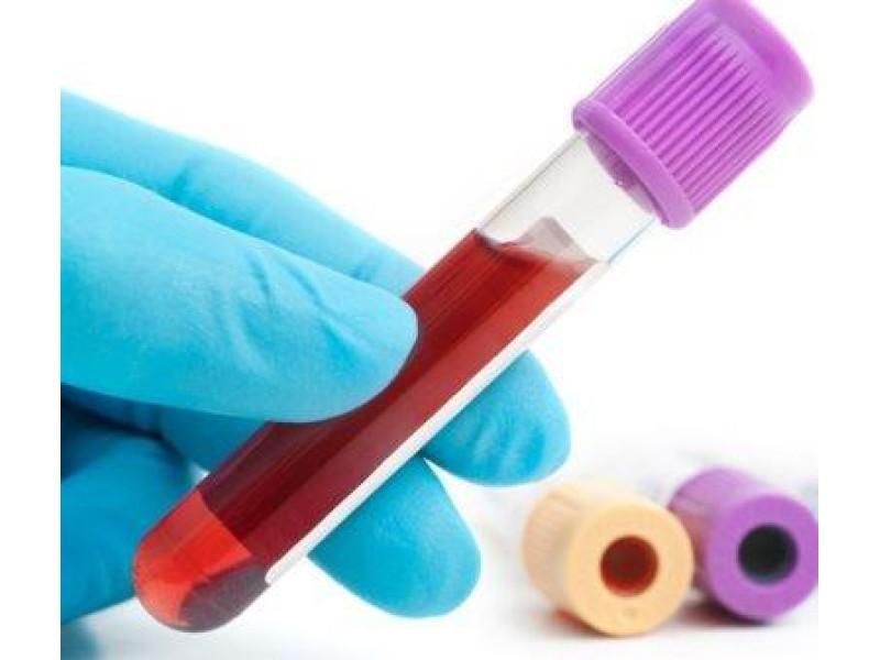 What is blood viscosity?